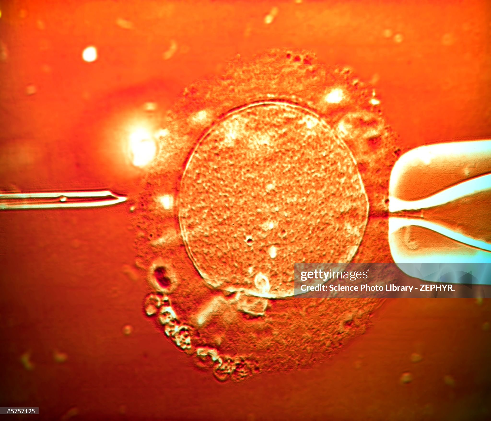 Alabama Declares War on In vitro fertilization